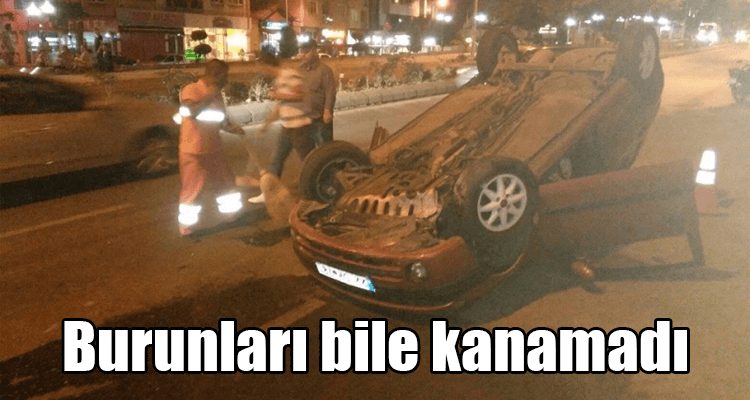 Burunları Bile Kanamadı