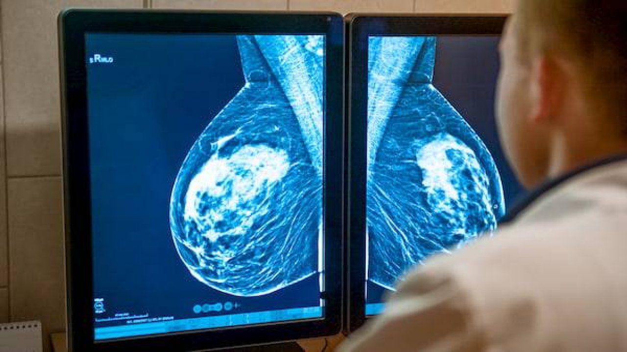 Medicana'dan Meme Kanseri Riski Uyarısı Yapıldı